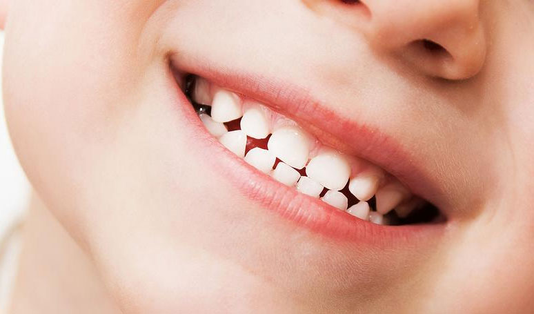 teeth grinding in children